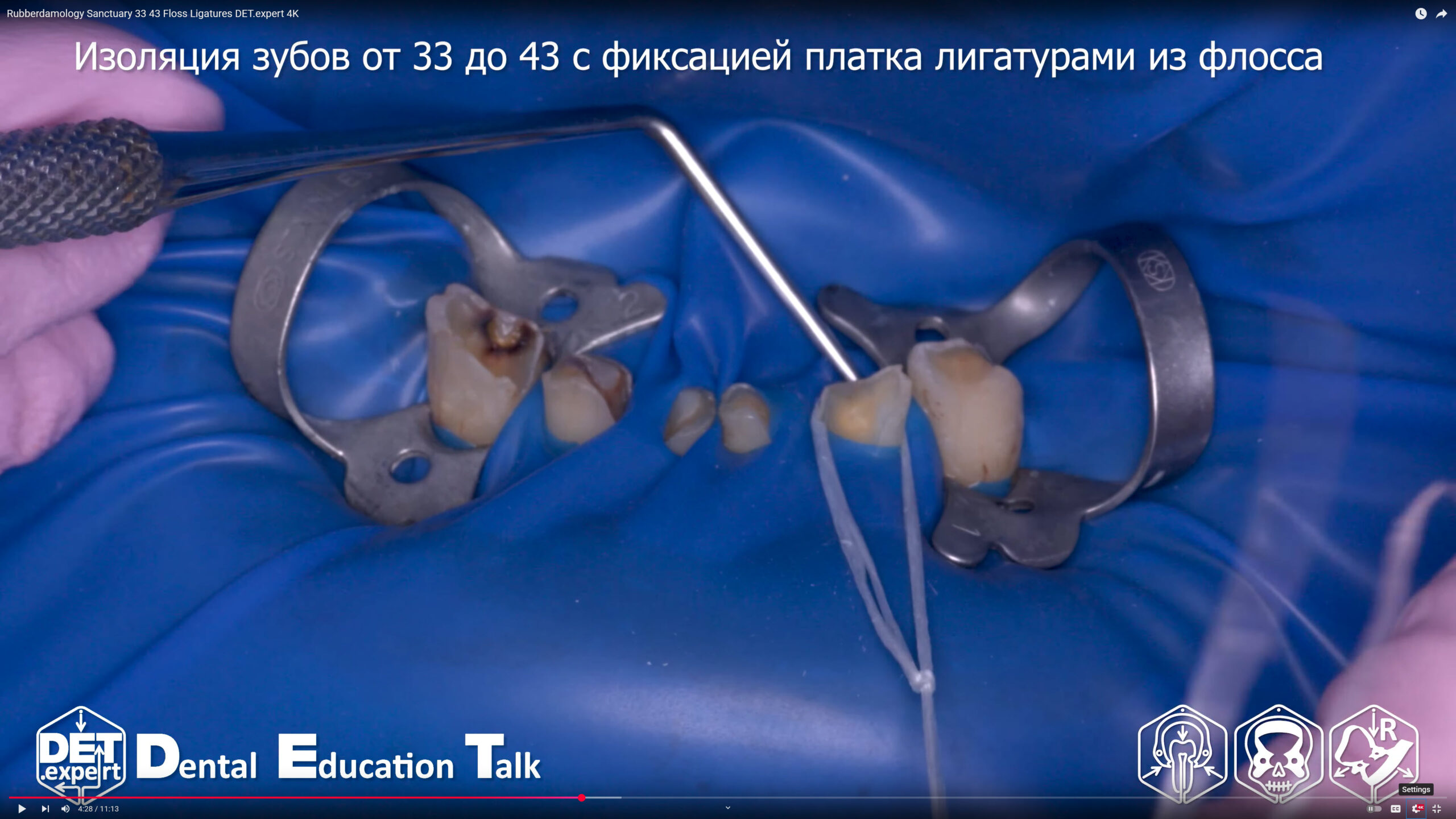 Rubberdamology Sanctuary 33 43 Floss Ligatures TORVM & Sanctuary 4K